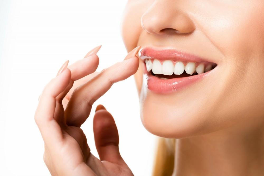 Dental-Veneers