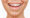 Dental-Veneers