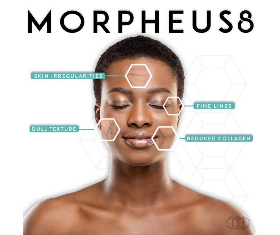 Morpheus8
