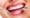 cosmetic-dentistry-in-Vyttila
