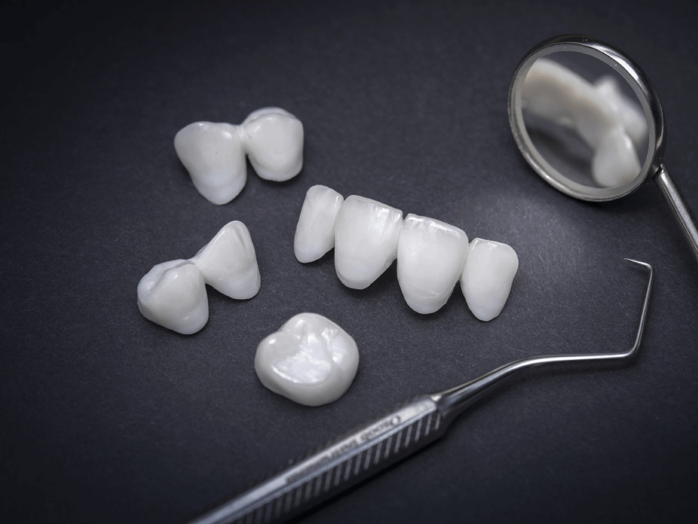 urgent-dental-nc-dental-veneers-crowns