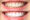 zoom teeth whitening